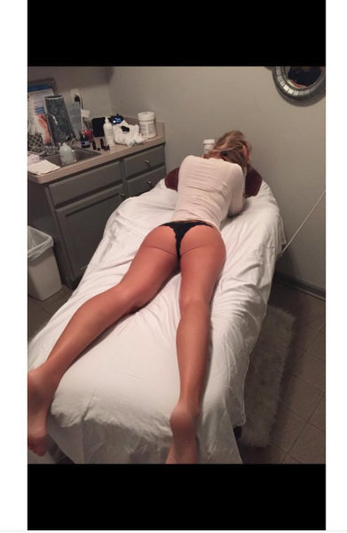 Kim Zolciak anti-cellulite treatment