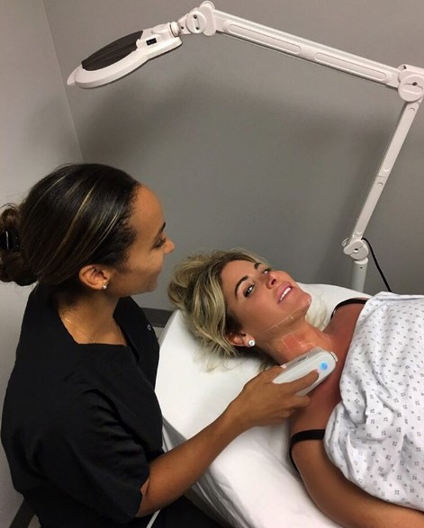 Kim-Zolciak-ultherapy